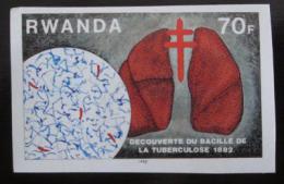 Poštovní známka Rwanda 1982 Plíce, neperf. Mi# 1189 B