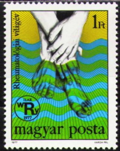 Poštovní známka Maïarsko 1977 Boj s revmatismem Mi# 3238